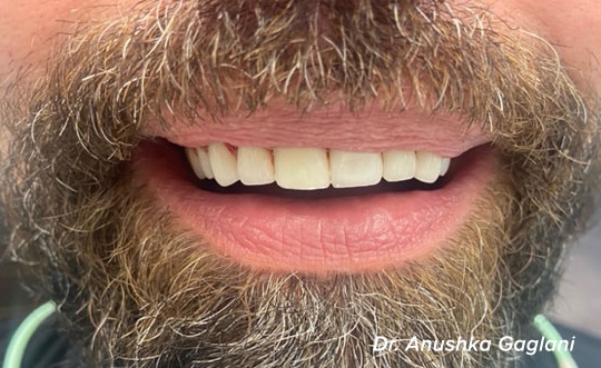 Dental Office in St. John IN