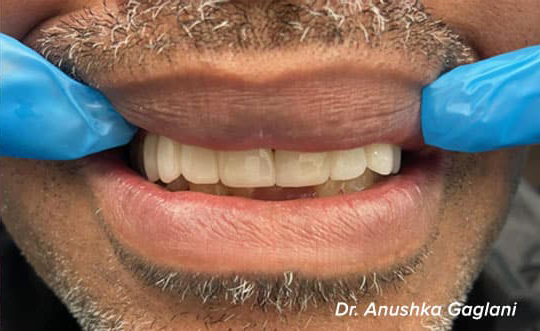 Dentist in St. John IN