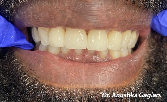 St. John Smiles Family Dentistry | Dentures, TMJ Disorders and CBCT