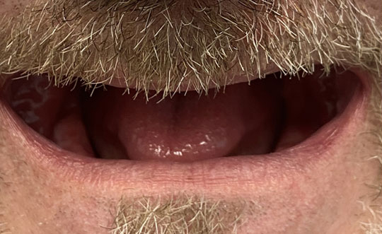 St. John IN Cosmetic Dentist