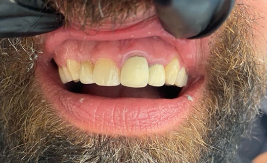 St. John IN Cosmetic Dentist