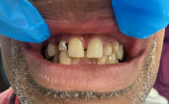 Dental Office in St. John IN