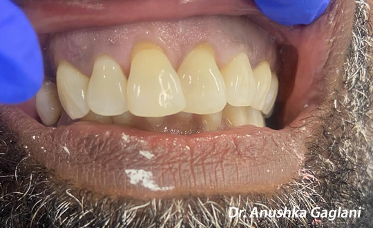 St. John Smiles Family Dentistry | Laser Dentistry, Teeth Whitening and Implant Dentistry