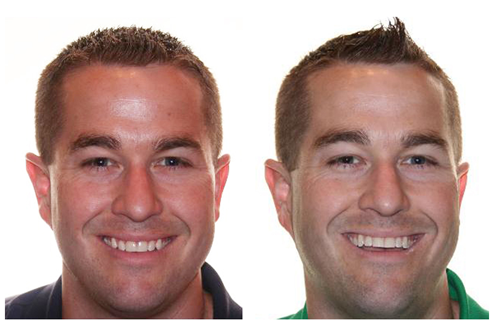 St. John Smiles Family Dentistry