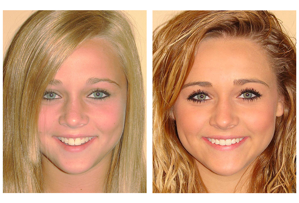 St. John Smiles Family Dentistry