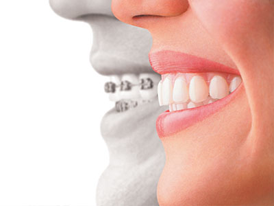 St. John Smiles Family Dentistry | Dental Fillings, Oral Exams and All-on-4 reg 