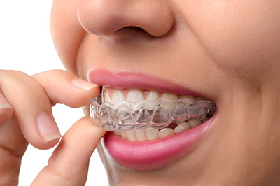 Invisalign in St. John IN