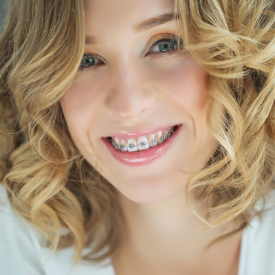 St. John Smiles Family Dentistry | Sports Mouthguards, Dentures and Invisalign reg 