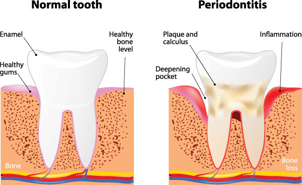 St. John Smiles Family Dentistry | Veneers, All-on-4 reg  and Implant Restorations